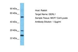 Derlin 1 Rabbit anti-Human, Polyclonal, Novus Biologicals 0.1 mL | Buy Online | Novus Biologicals | Fisher Scientific